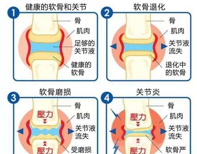 钙尔奇是哪个国家的，青少年补钙和锌哪个牌子好？图10