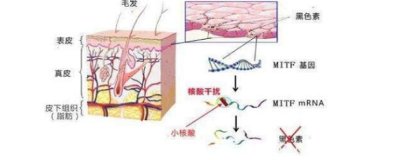 ​激光美容的危害有哪些