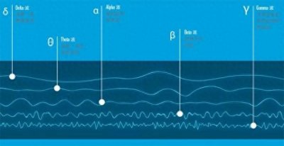 ​阿尔法脑波音乐到底有多神奇？科学家告诉你！