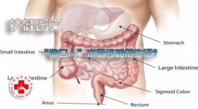 ​「护健图文」“造口人”术后该如何生活？